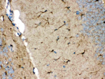 Anti-NDRG2 Antibody