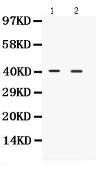 Anti-NDRG2 Antibody