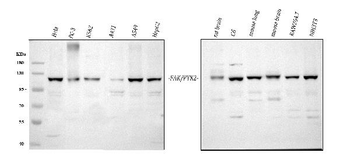 FAK/PTK2 Rabbit Polyclonal Antibody
