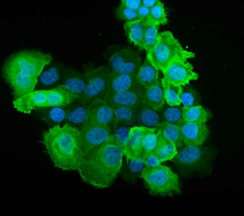Anti-S100 alpha 6/S100A6 Antibody
