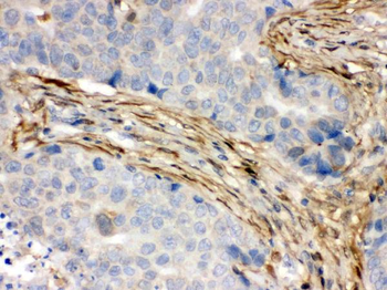 Anti-S100 alpha 6/S100A6 Antibody