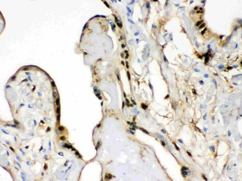 Anti-S100 alpha 6/S100A6 Antibody