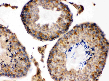 Anti-S100 alpha 6/S100A6 Antibody