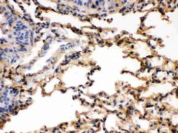 Anti-S100 alpha 6/S100A6 Antibody