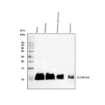 Anti-S100 alpha 6/S100A6 Antibody