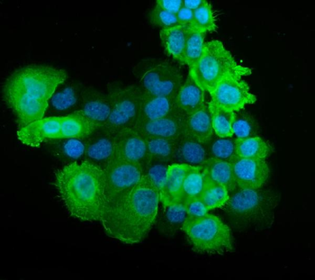 Anti-S100A9 Antibody
