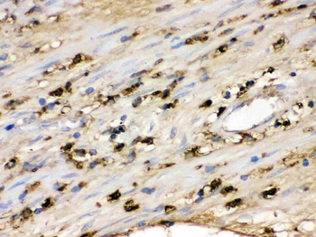 Anti-S100A9 Antibody
