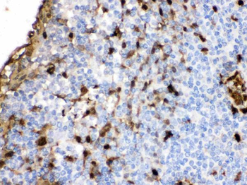 Anti-S100A9 Antibody
