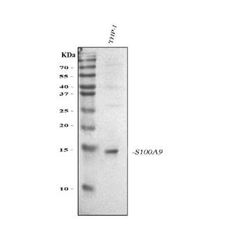 Anti-S100A9 Antibody