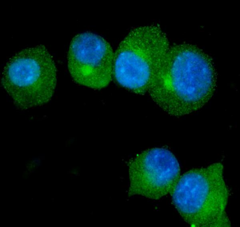 Anti-S100A9 Antibody