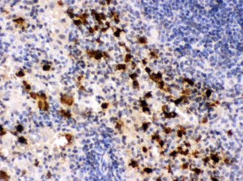 Anti-S100A9 Antibody