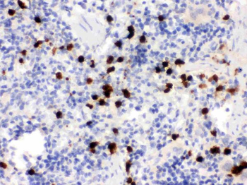 Anti-S100A9 Antibody
