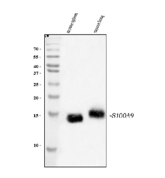 Anti-S100A9 Antibody
