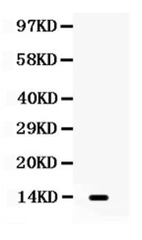 Anti-Lymphotactin/XCL1 Antibody