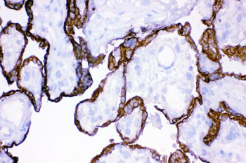 Anti-HSD11B2 Antibody
