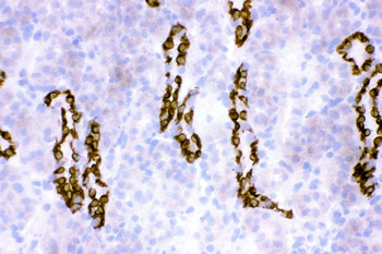 Anti-HSD11B2 Antibody