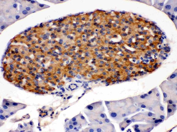 Anti-HSD11B2 Antibody