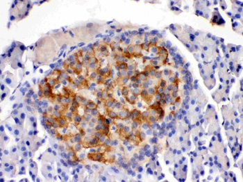 Anti-HSD11B2 Antibody