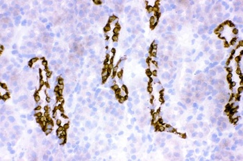 HSD11B2 Antibody
