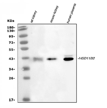 Anti-HSD11B2 Antibody