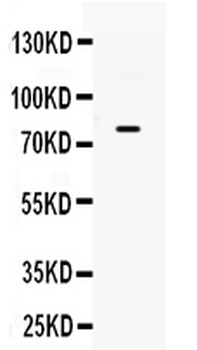 GRK3/ADRBK2 Antibody