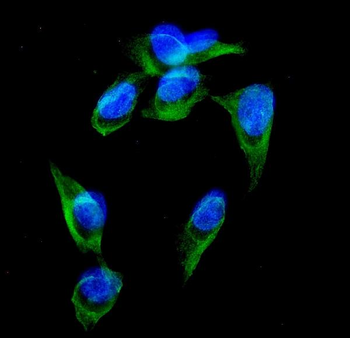 Anti-GRK3/ADRBK2 Antibody