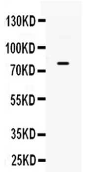 Anti-GRK3/ADRBK2 Antibody