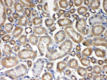 Anti-AIM2 Antibody
