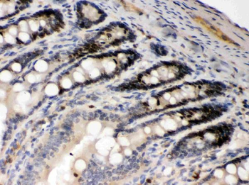 Anti-AIM2 Antibody