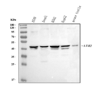 Anti-AIM2 Antibody