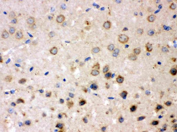 Anti-FE65/APBB1 Antibody