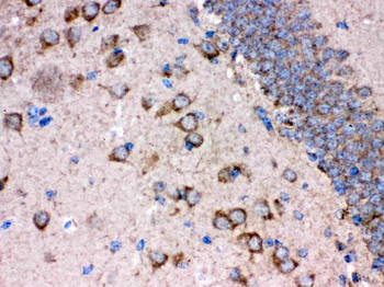Anti-FE65/APBB1 Antibody
