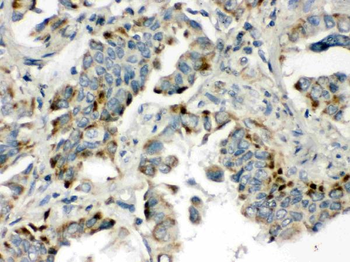 Anti-BMP5 Antibody