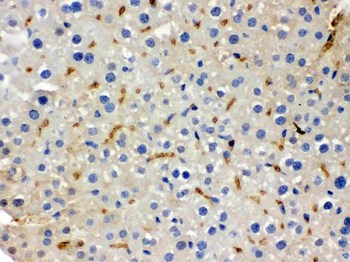 Anti-BMP5 Antibody