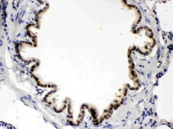 Anti-BMP5 Antibody
