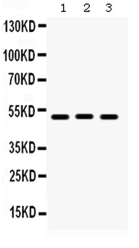 Anti-BMP5 Antibody