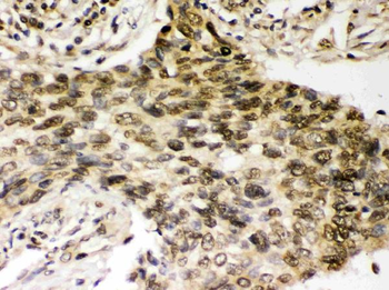 Chk2/CHEK2 Rabbit Polyclonal Antibody