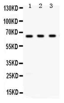 Anti-Chk2/CHEK2 Antibody
