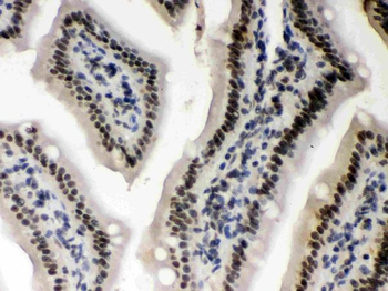 Anti-Caseine Kinase 1 alpha/CSNK1A1 Antibody