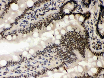 Anti-Caseine Kinase 1 alpha/CSNK1A1 Antibody