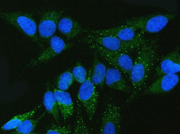 FMRP/FMR1 Rabbit Polyclonal Antibody