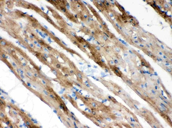 Anti-FXYD1 Antibody