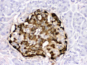 Anti-GLP1/GCG Antibody