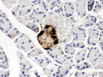 Anti-GLP1/GCG Antibody