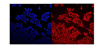 Anti-GNAQ Antibody