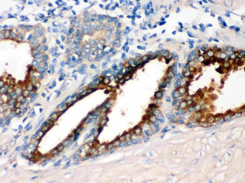 Anti-GNAQ Antibody