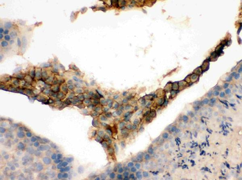 Anti-GNAQ Antibody