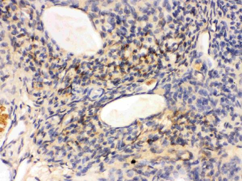 Anti-GNAQ Antibody
