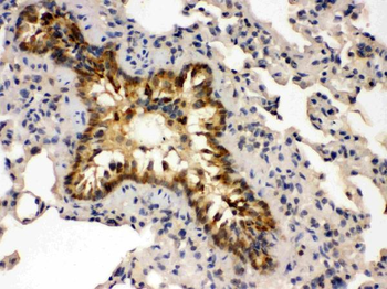 Anti-GRK5 Antibody