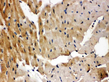 Anti-GRK5 Antibody